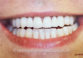 Case4 Before